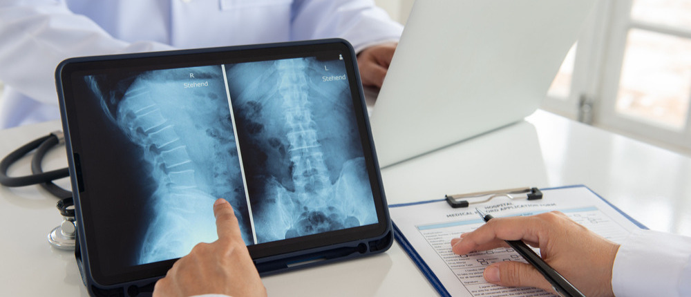 diagnóstico por imagem: médico analisando raio-x de coluna em tablet