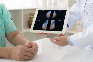 mamografia-futuro-atendimento-medico