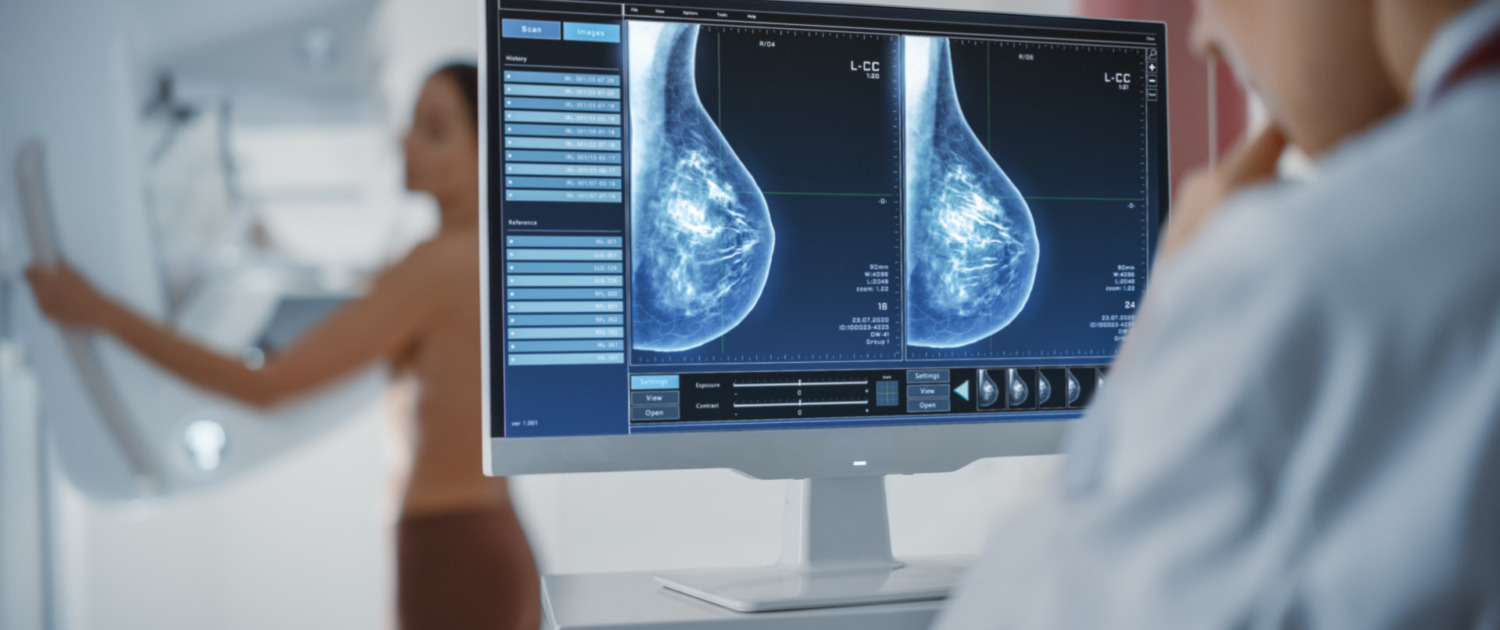 prática da mastologia mulher realizando exame de mamografia e médica analisando