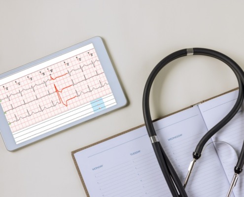 tablet con informe de electrocardiograma y aparatos médicos