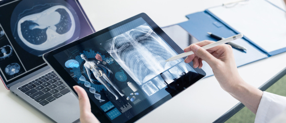 informe médico en un tablet por telemedicina que aumenta la capacidad de atención de salud