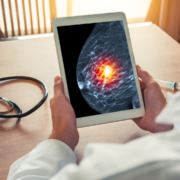 médico analisando uma o resultado de uma mamografia no tablet