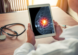 médico analisando uma o resultado de uma mamografia no tablet