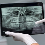 radiografia de boca em tablet com dentista apontando dente específico dos fundos