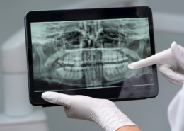 radiografia de boca em tablet com dentista apontando dente específico dos fundos