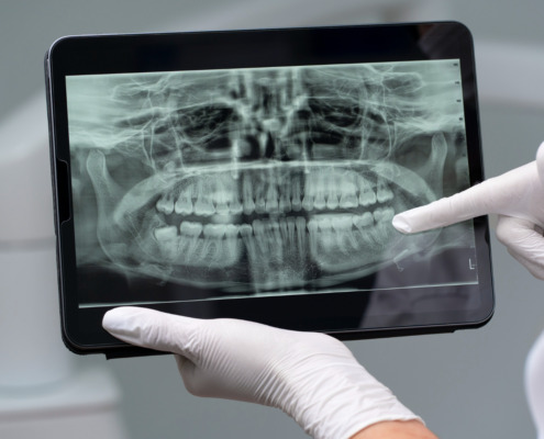 radiografia de boca em tablet com dentista apontando dente específico dos fundos