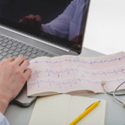 notebook na mesa com resultado de eletrocardiograma