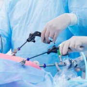 imagem de cirurgia feita com lapiroscopia