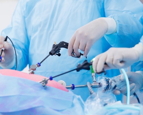 imagem de cirurgia feita com lapiroscopia