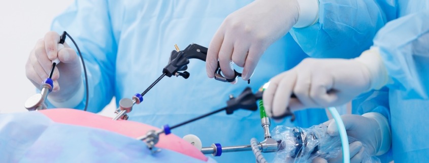 imagem de cirurgia feita com lapiroscopia