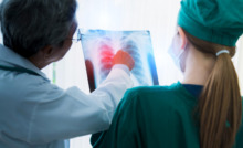 médico analisando raio-x com outra profissional de saúde