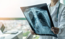 médica em pé analisando radiografia do pulmão