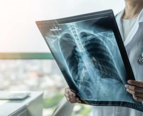 médica em pé analisando radiografia do pulmão