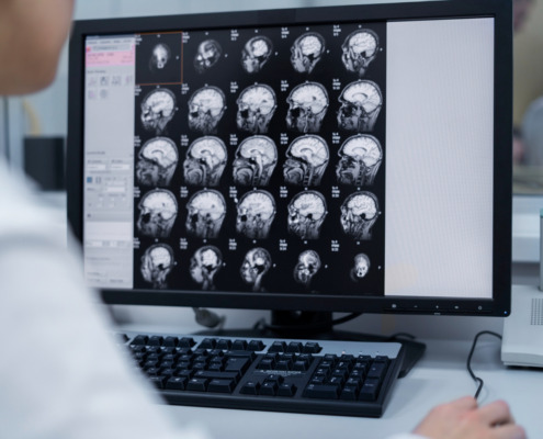 médica avalia radiologias de crânio em tela de notebook