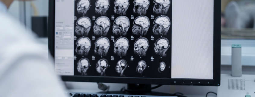 médica avalia radiologias de crânio em tela de notebook